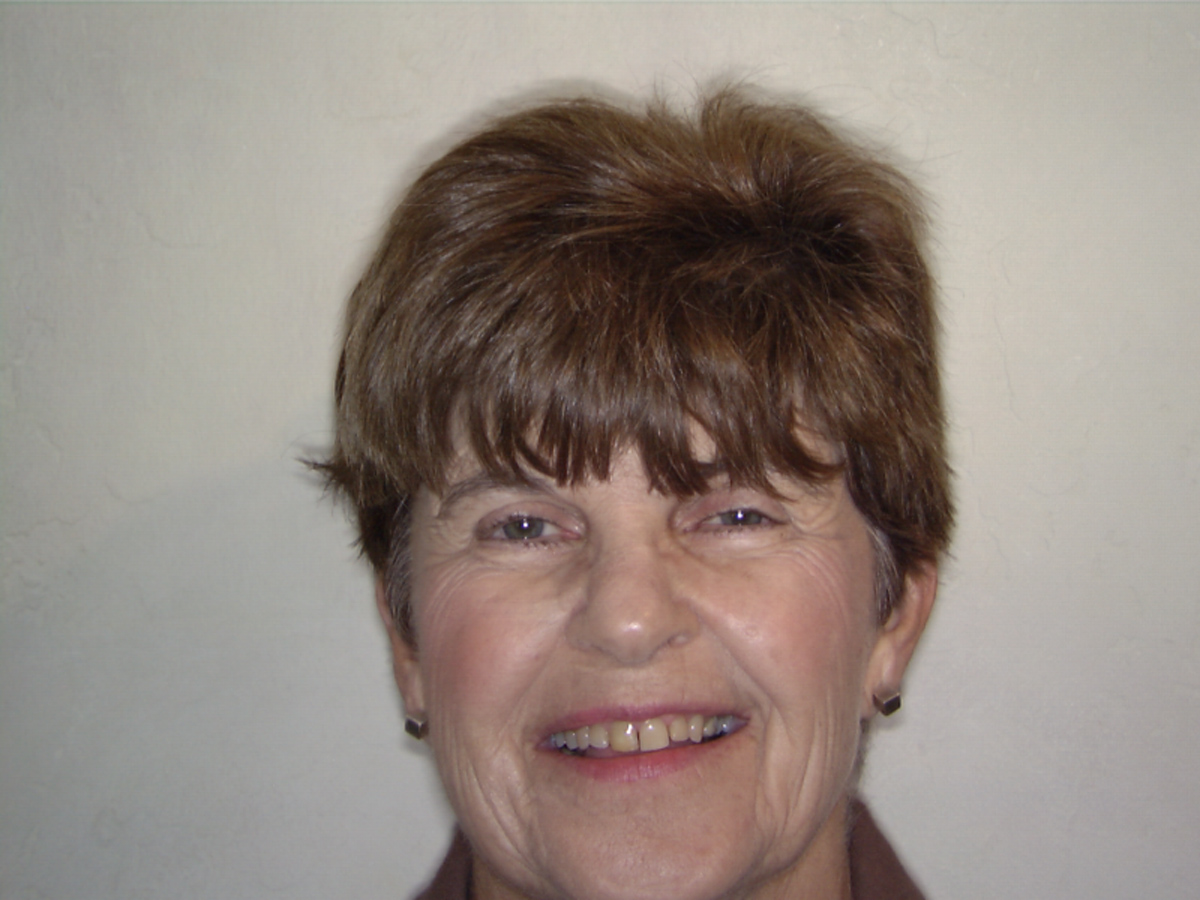 smile-gallery gallery