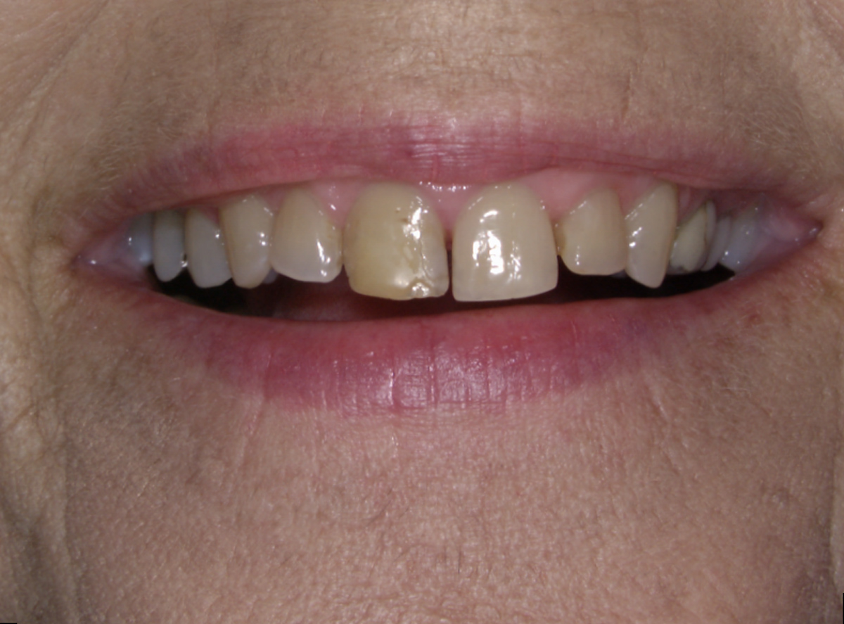 smile-gallery gallery