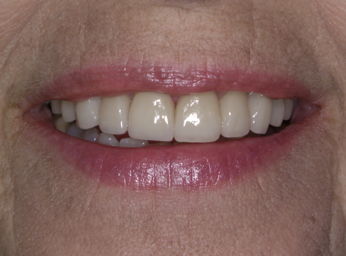 smile-gallery gallery