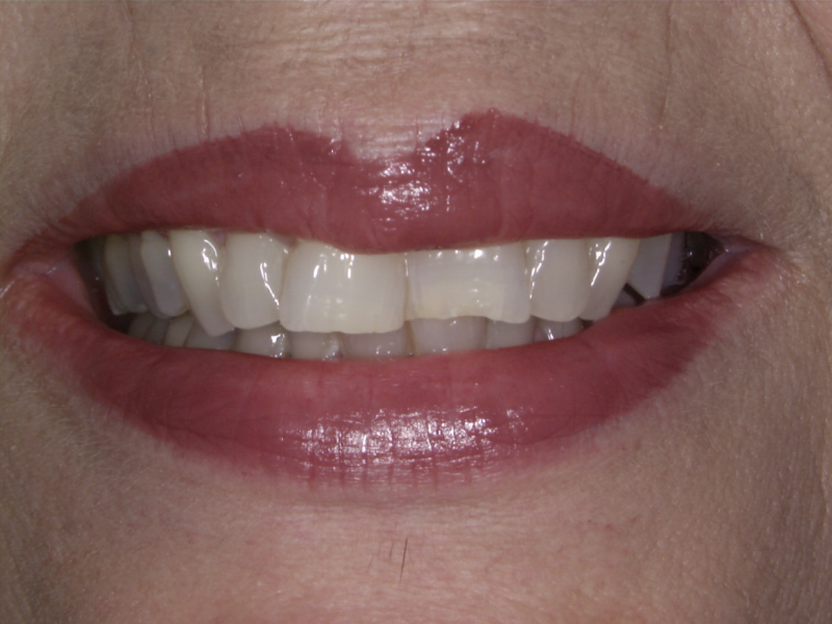 smile-gallery gallery