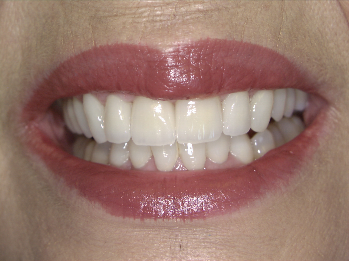 smile-gallery gallery