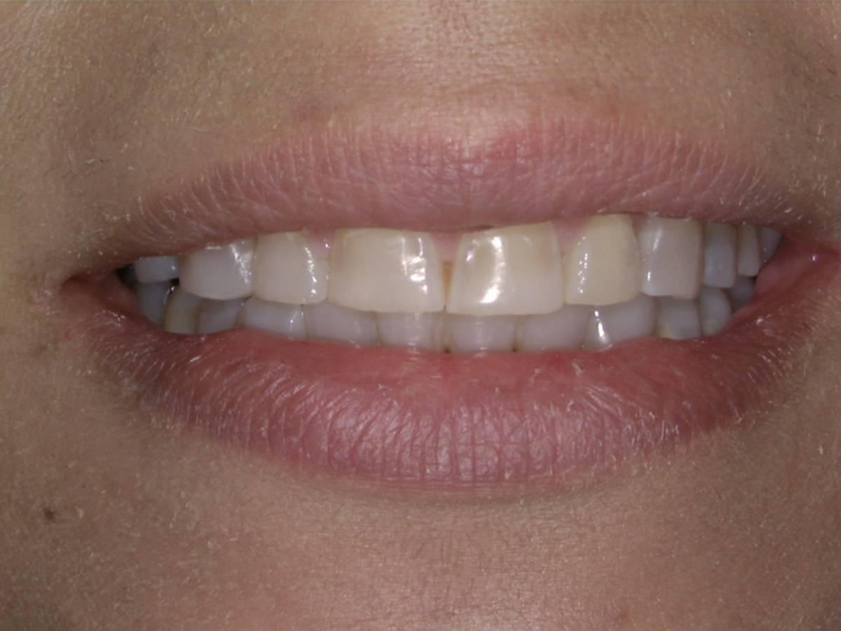 smile-gallery gallery