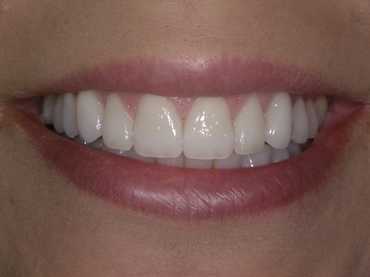 smile-gallery gallery