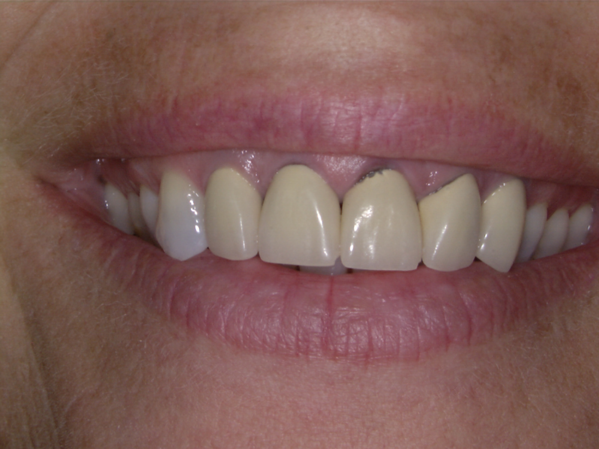 smile-gallery gallery