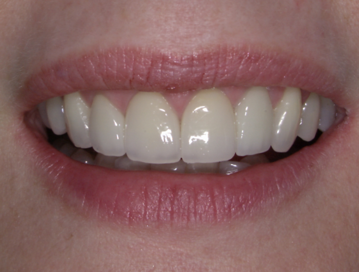 smile-gallery gallery