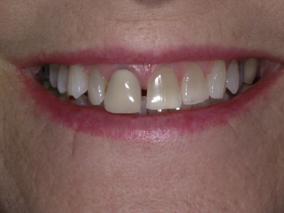 smile-gallery gallery