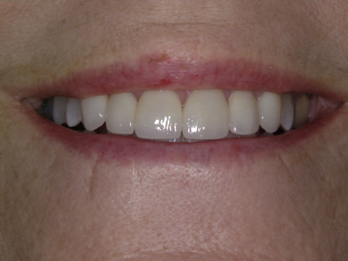 smile-gallery gallery