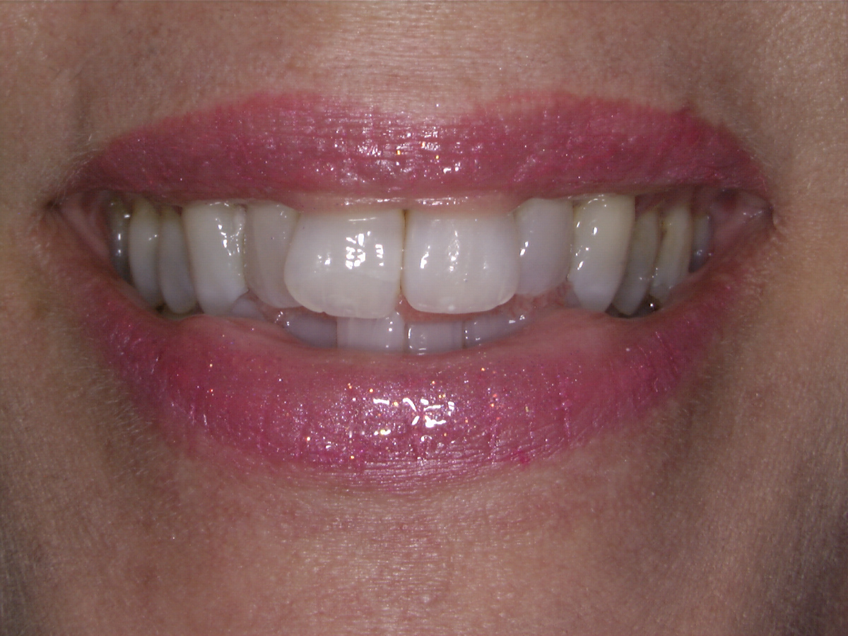 smile-gallery gallery