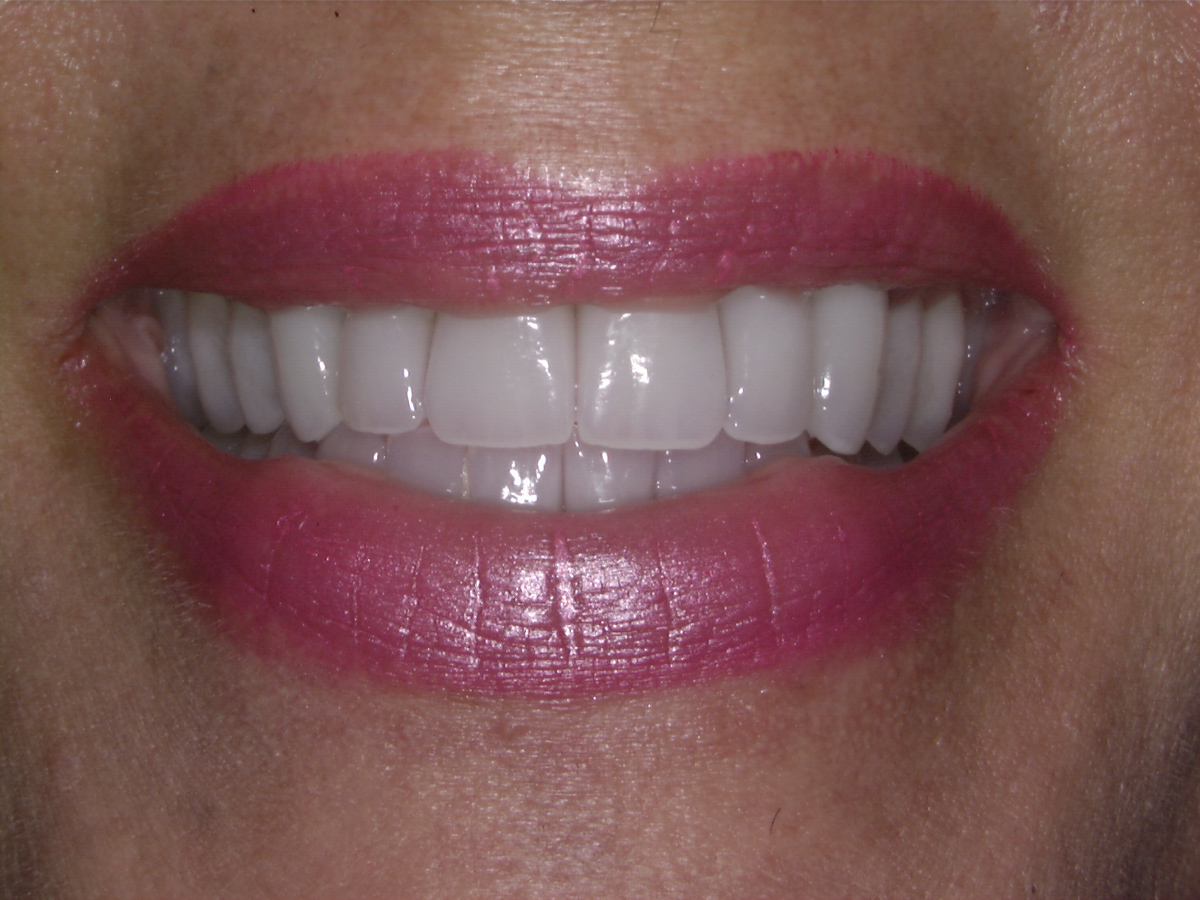 smile-gallery gallery